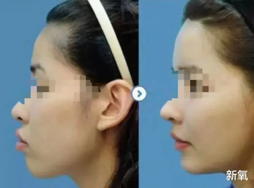 华晨宇|从头皮换到脸皮，华晨宇做过的项目比他的作品还多吧？