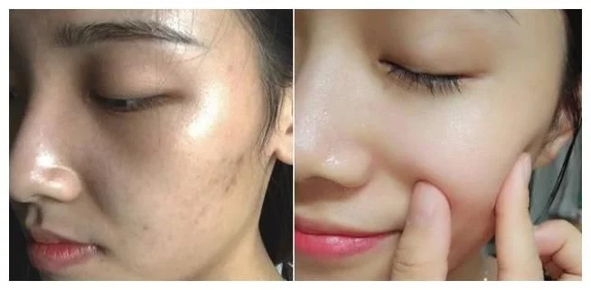 资生堂|李佳琦随手一晒的精华液火了，提亮嫩肤去黄气，曾因价低被看不起！
