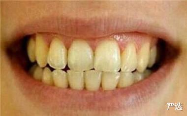 严选 为什么天天刷牙,牙齿还是又臭又黄?专家:没用对牙膏牙齿白刷了