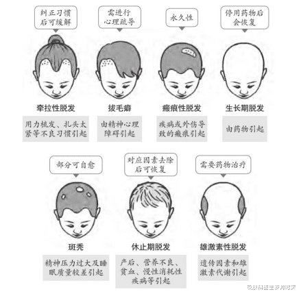 肾病|脱发能够恢复吗?8种常见性脱发,快收藏