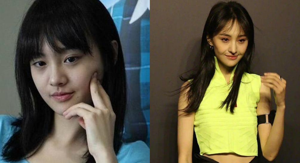 整容|娱乐圈整容失败的十大女星，郑爽为了爱情，而她是因为观众吐槽