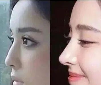 古力娜扎|6位颜值下降的明星，娜扎鼻子看不见鼻孔，古天乐内双变大双眼皮