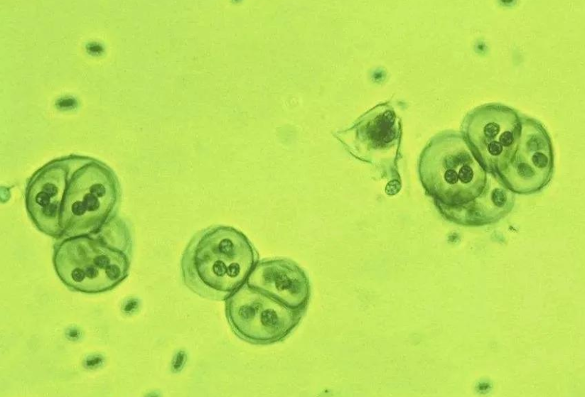 地球究竟是如何成为唯一已知拥有富氧大气层的行星?