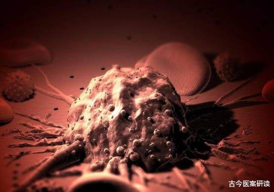 胃癌|伤胃“祸首”已公布，不是酒精和火锅，医生：若爱吃，小心胃癌“找上门”