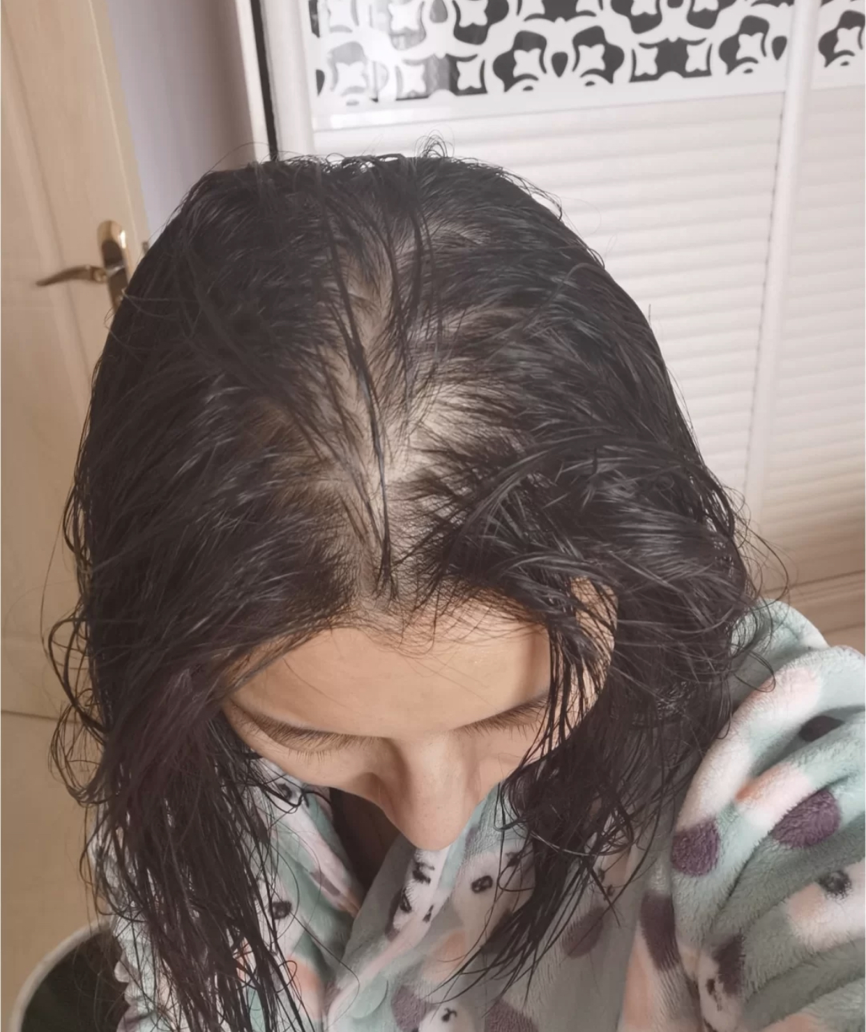 按摩|头发干枯毛躁？别急着用洗发水，试试这几个小妙招！