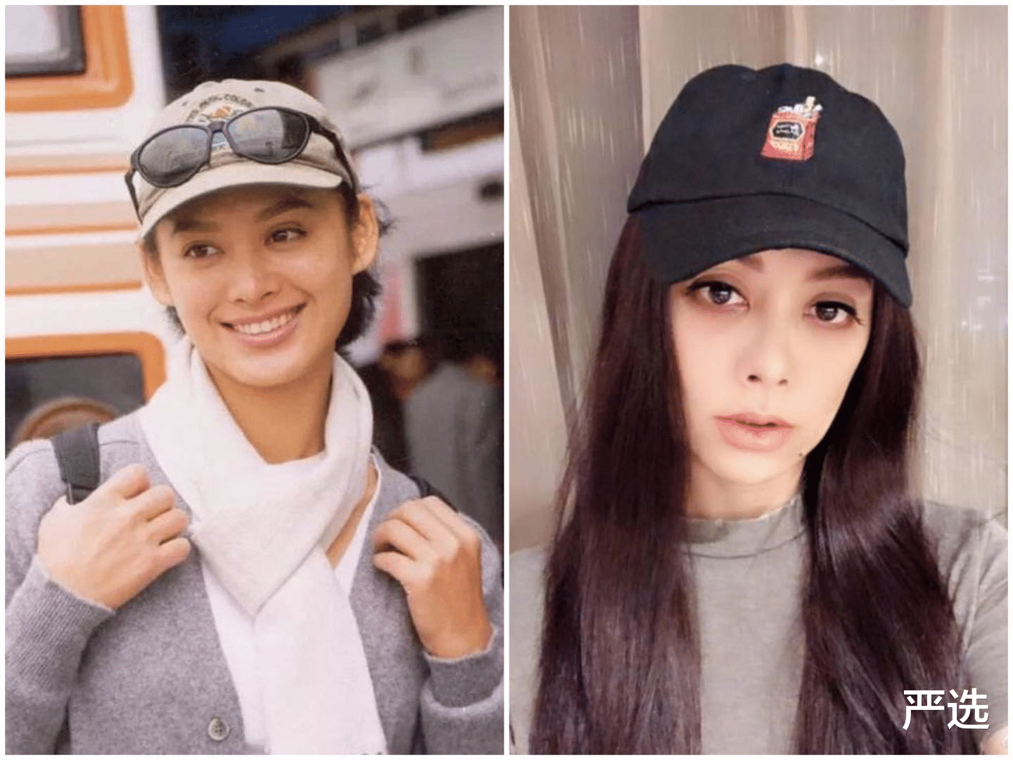 严选|为抗老注射“玻尿酸”变面瘫的女人,现在啥样?过来人:追悔莫及