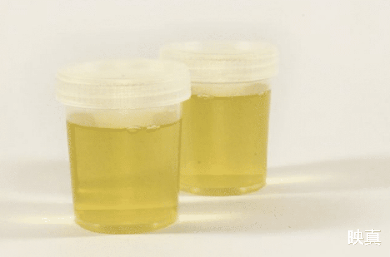 疯狂|为了提取黄金，他煮沸了5000升尿液，意外获得了造福人类的新物质