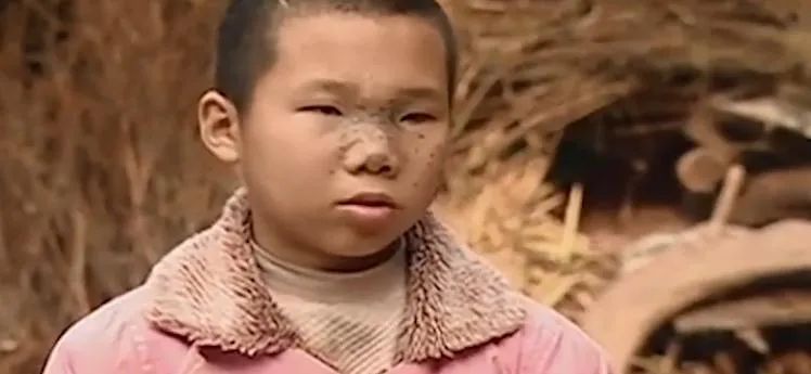 蹦极 那个全脸都是弹片的女孩