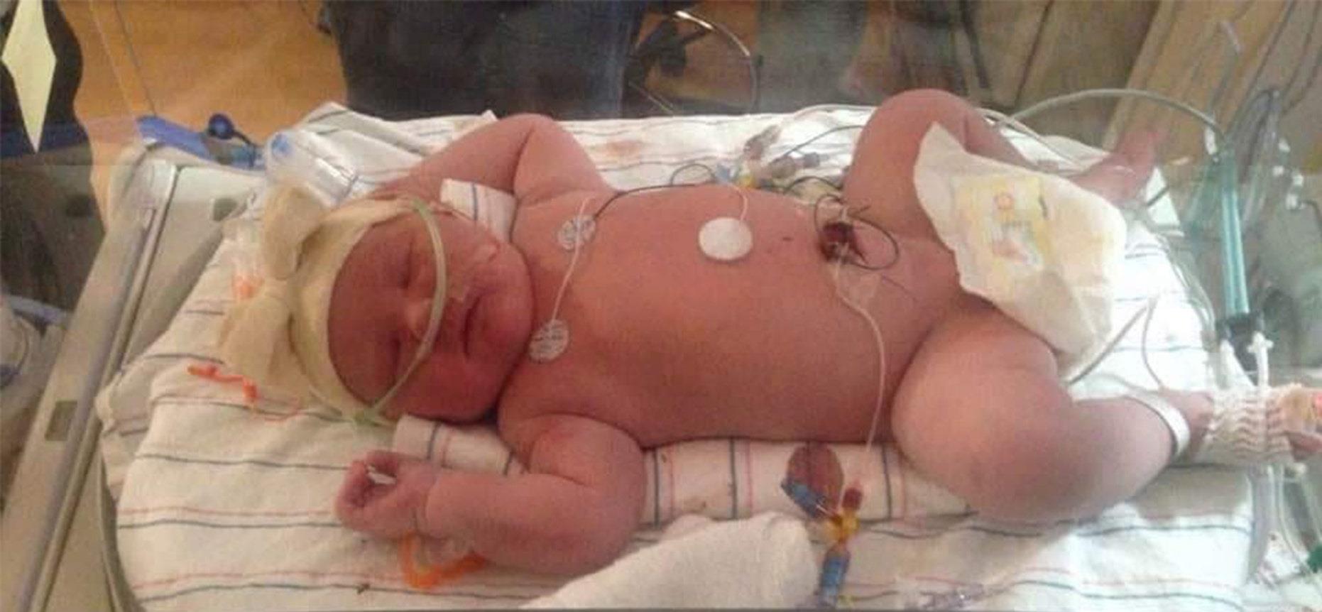 梦想中的 外国女子37周生下个大胖小子，体重超11斤，看起来像3个月大