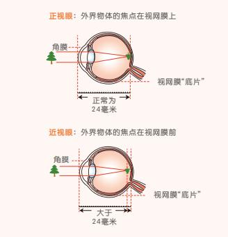 身份证|「提醒」2岁男童近视700度！别再拿手机当“哄娃神器”了