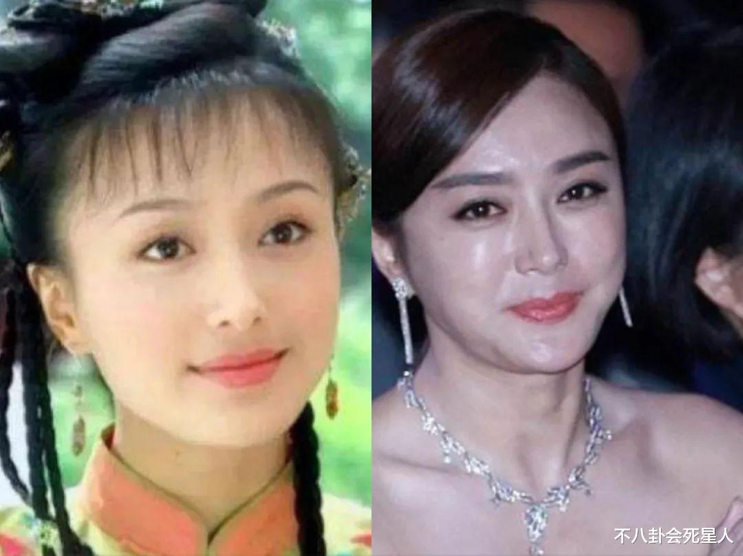 小姐姐|那些打过美容针的女星怎么样了？活得像假人，一堆后遗症