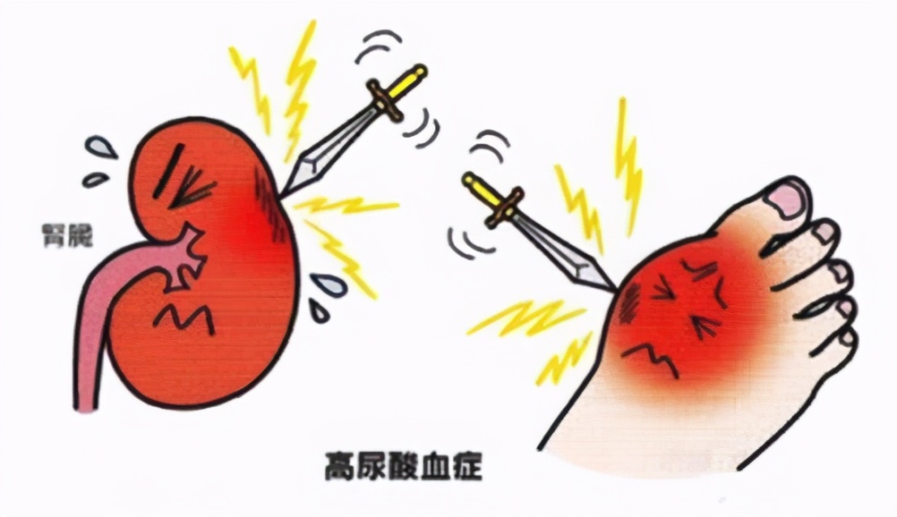 尿酸|“嘌呤大户”已宣布，是猪肉的42倍，很多人都当成宝，难怪肾脏受不了