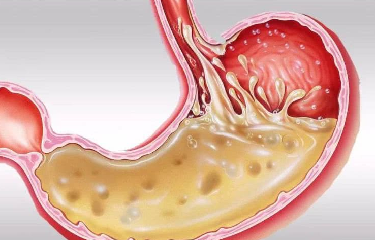 纤靓惠美体汇|把50cm“仙女管”塞入胃里的女孩儿,是自虐上瘾吗?