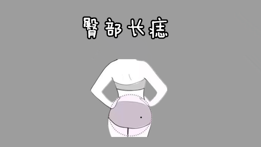 中国易经风水|身上5颗“暗财”痣，个个藏而不漏，容易发大财，中晚年运势好！