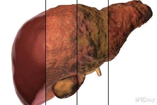 木耳|木耳是“血脂清道夫”？木耳配上这“1物”，或助你血脂轻松降下来
