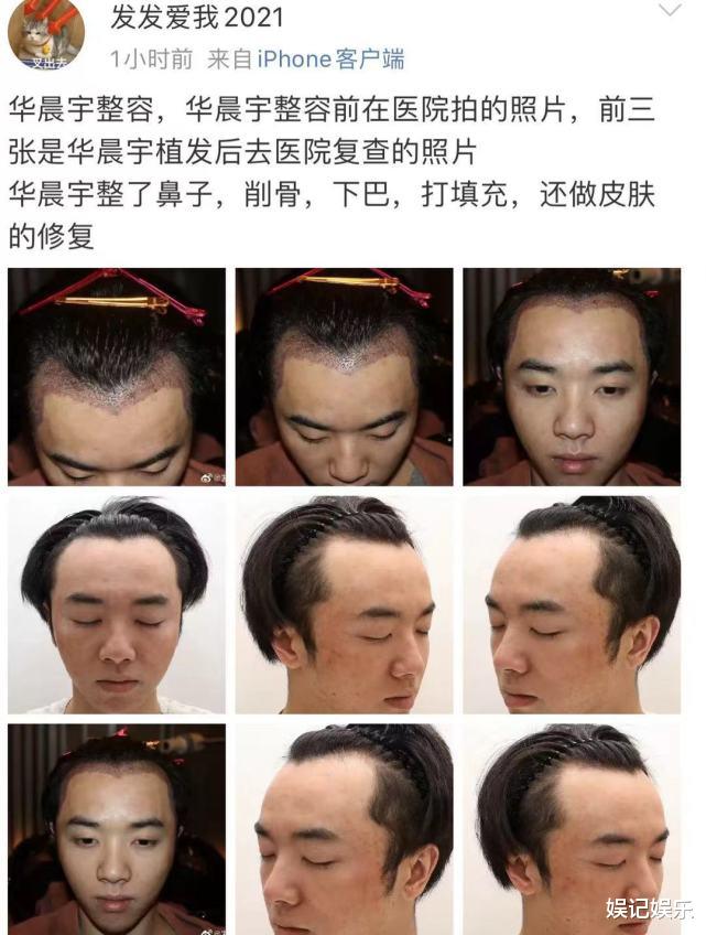 华晨宇|张碧晨否认插足后首晒自拍，疑跟华晨宇戴情侣戒指，表白手势超甜