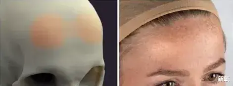 发际线 每个人造美女，都畏惧这种地狱级变美难度的骨相