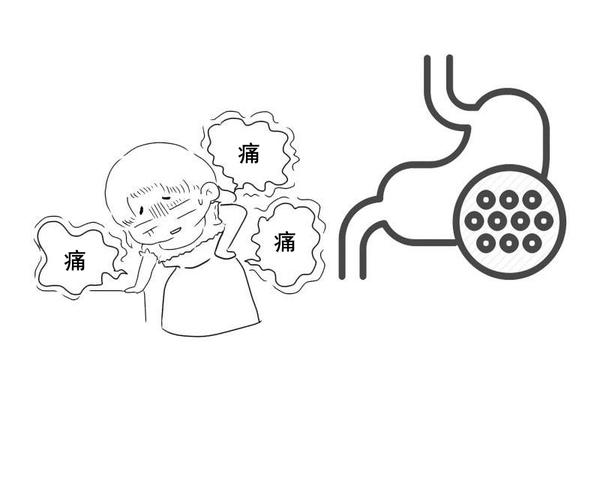 运动|肠胃病来得快，去得慢！想要“赶走”肠胃炎，有几点你可以了解下