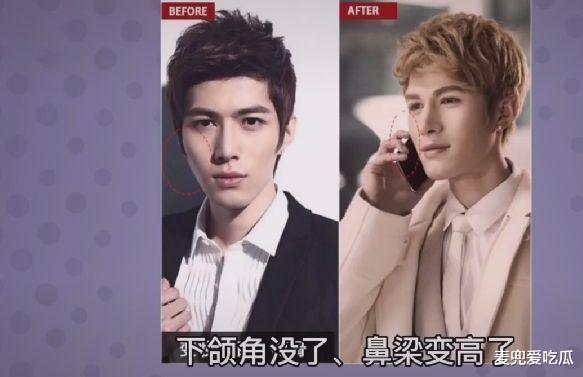 陈学冬|博主点评男星整容？王一博鼻子出现后遗症，陈伟霆陈学冬调整最大