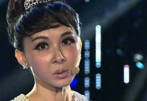 娱乐圈|被“玻尿酸”毁容的女星，惨不忍睹贴门上能辟邪！网友：适可而止！