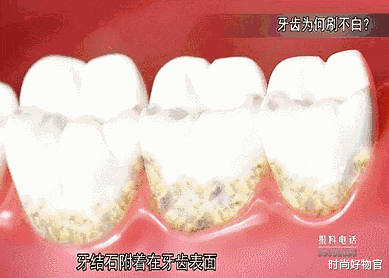 时尚好物官 我国一不起眼的牙膏,因\"价低\"被嫌弃, 网友: 用后牙齿亮白口气清新