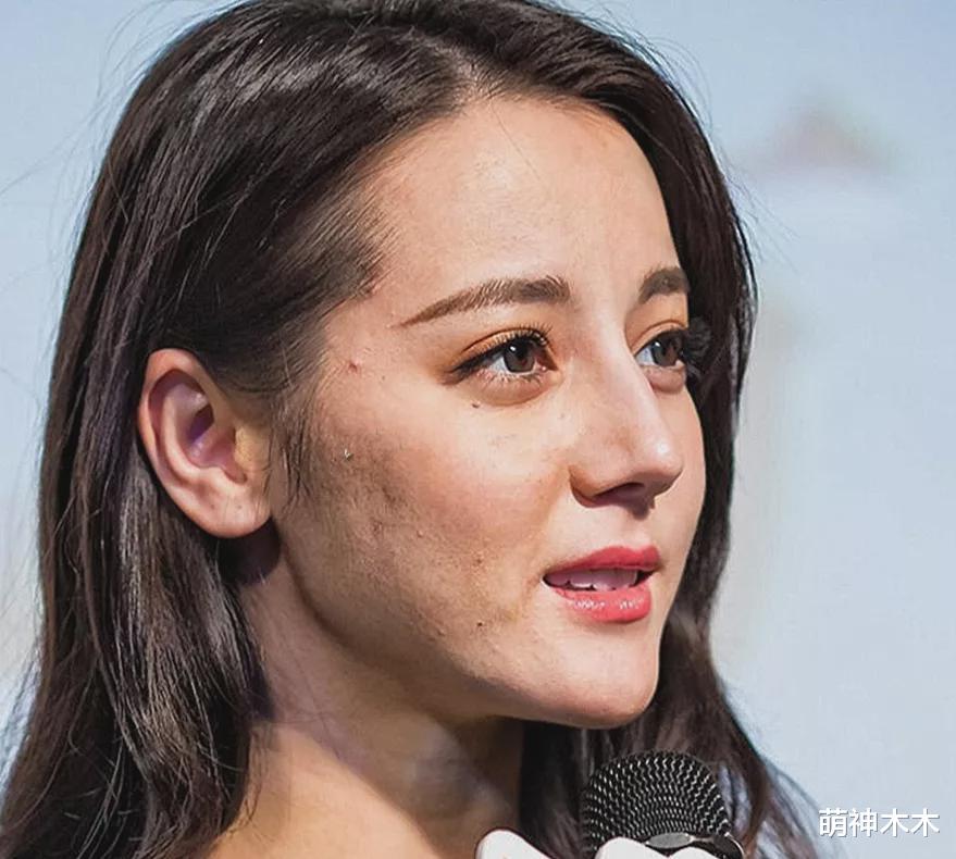 迪丽热巴|真实！明星大量未修图曝光，热巴毛孔闭口一堆，杨幂皮肤松垮