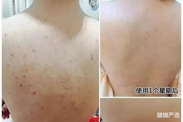 保湿 42岁黄晓明的颜值像坐过山车，皮肤却嫩如婴儿，坦言护肤无非2点