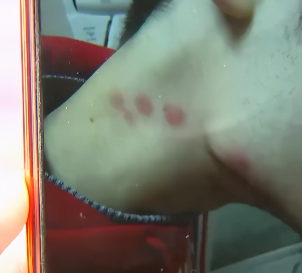 民生小鱼 租住青旅多处被虫咬伤,男子要求退款被拒,店家:你自己愿意住!