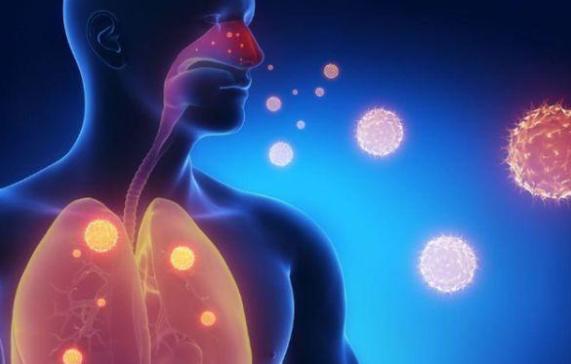 致癌物|肺部不适,喉咙先知?若喉咙出现3个表现,建议尽早做肺部检查