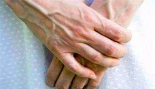 医生|有些人手臂上“青筋暴起”，有些人却看不到，为什么？听医生科普