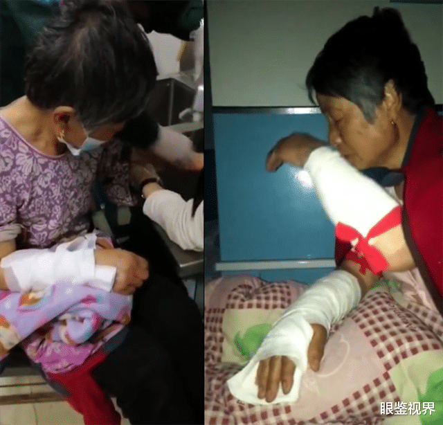 眼鉴视界 黑龙江肇东：家中养了2年的狗突然发狂，老人手臂直接被咬折