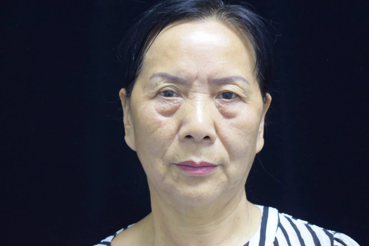 严选 女性开始衰老的标志:1处变圆,2处变长,若都没有,说明还年轻