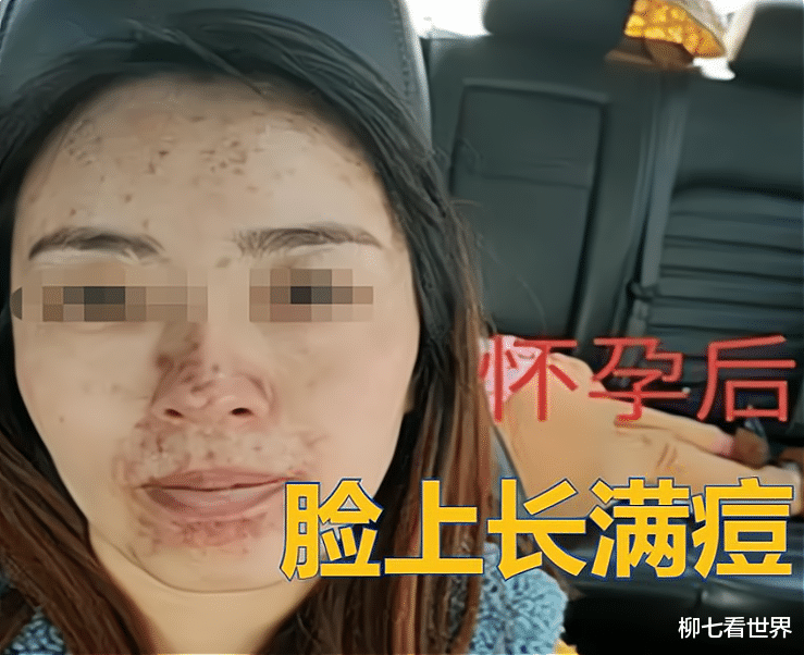 张子健|“整容女”嫁给高富帅，怀孕后原形毕露，丈夫的反应异于常人