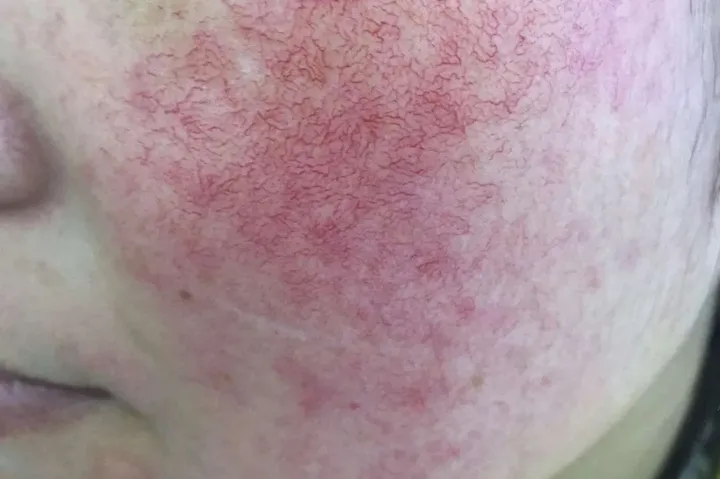 萌萌一笔|敏感肌肤怎么修复呢?