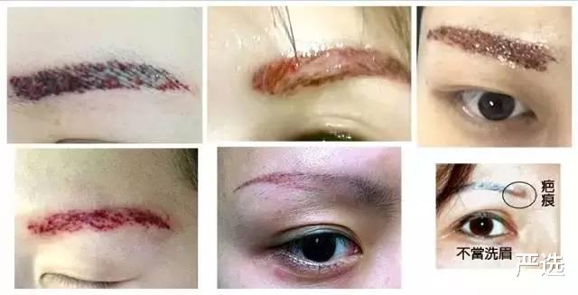 运动 纹过“眉毛”的女生，几年后会有怎样的变化，一起来看看结果如何