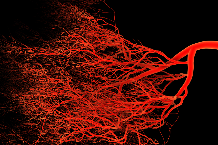 咳嗽|天然“溶栓帮手”就在厨房，不是山楂，或是爱喝，或能冲走血管脂质