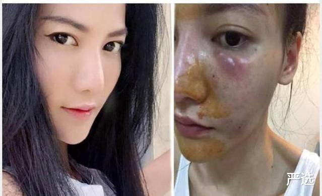 严选|女星的3种美白方式,特别容易“烂脸”损伤肌肤,你都用过哪个?