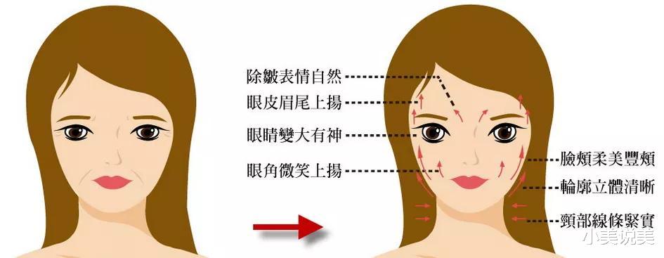 皮草 喏！你的入冬四件套，别的小朋友有的你也要有