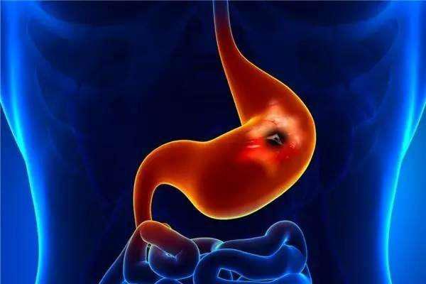 馒头|胃不好，身体会发出3个“警告”，占其一，胃或已“烂如渔网”