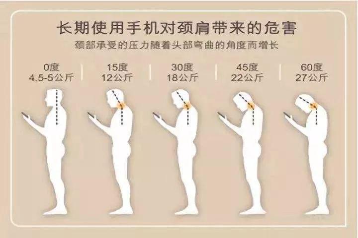 峰哥说表|十个颈椎，八个痛，教你用一天时间缓解颈椎痛！