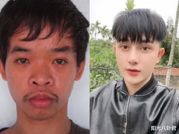 整容|失业丑男花天价9次整容撞脸张东健，大方晒整容前丑照，人生意外改变