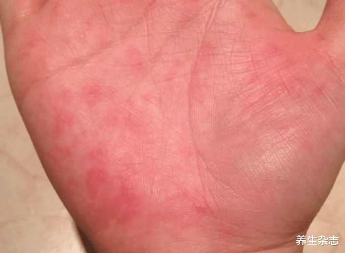 肝脏|?35岁男子滴酒不沾,检查出肝癌晚期,医生摇头叹息:这2事做太多了