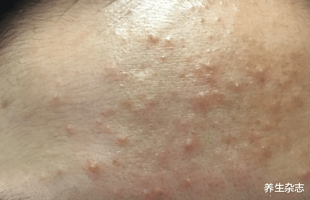 肝癌|丈夫被妻子一月“757”26次，肝癌离世，医生直言：妻子太“野蛮”