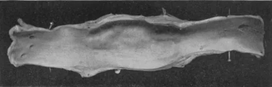 医学|他从文转理再学医，40岁前获诺贝尔奖，晚年却遭人唾弃