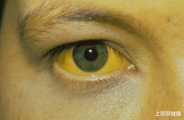 咳嗽|男子肩痛一年,确诊肝癌,医生:2个习惯或是“祸首”,劝你改正