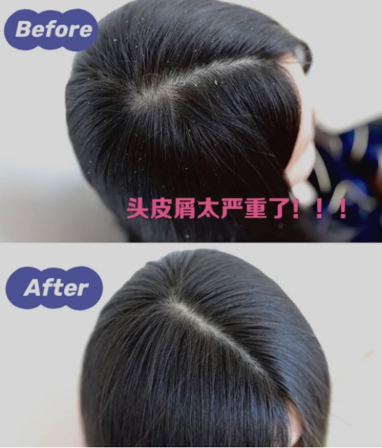 卓卓and然然|这几种有毒洗发水成分让孕妈崩溃，过敏，头屑，多数孕妈都踩过雷