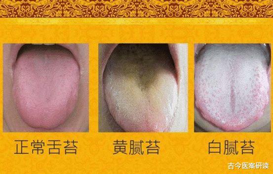 胃癌|伤胃“祸首”已公布，不是酒精和火锅，医生：若爱吃，小心胃癌“找上门”