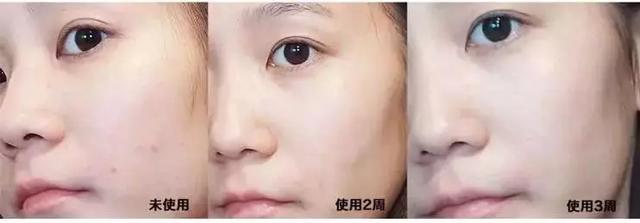 天蝎座|王鸥、张嘉倪公开了抗氧化秘诀:一天一片,21天肌肤光滑透亮