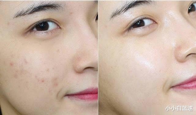 护肤|护肤建议：使用精华液的两个误区，注意不要踩雷，不然无效又伤肤