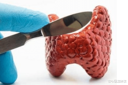 甲状腺结节|甲状腺结节“死对头”被发现，没事吃两口，消散结节，甲状腺笑开颜